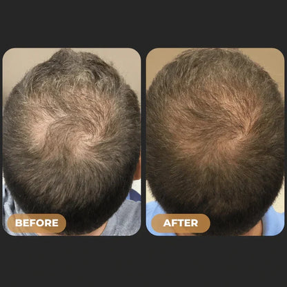 Spartan™ -  Root Activator Shampoo