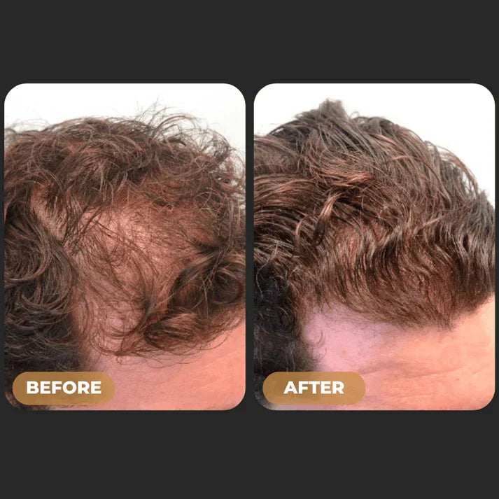 SPARTAN™ - Root Activator Spray