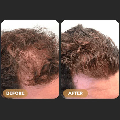 Spartan™ -  Root Activator Shampoo