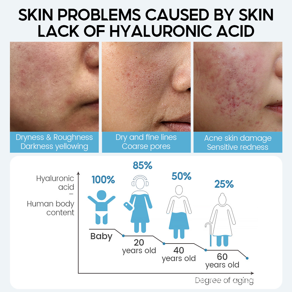 Vibrant Glamour™ - Hyaluronic Anti Aging Serum