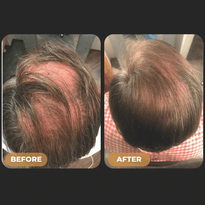 SPARTAN™ - Root Activator Spray